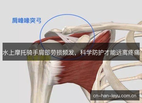 水上摩托骑手肩部劳损频发，科学防护才能远离疼痛